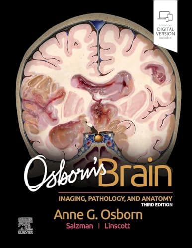 Osborn's Brain: 9780323477765: Medicine & Health Science Books